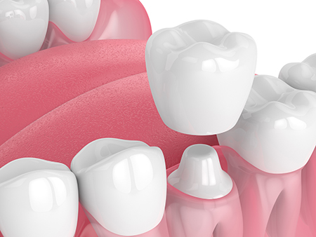 iCare Family Dentistry