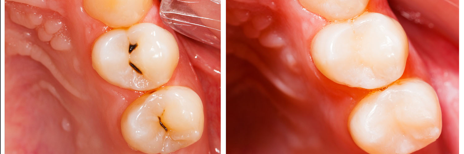 iCare Family Dentistry