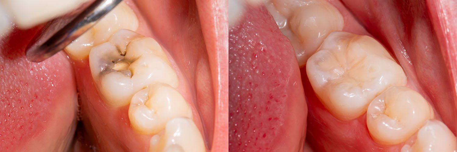 iCare Family Dentistry