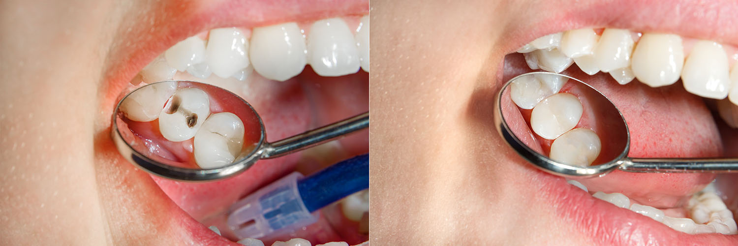 iCare Family Dentistry